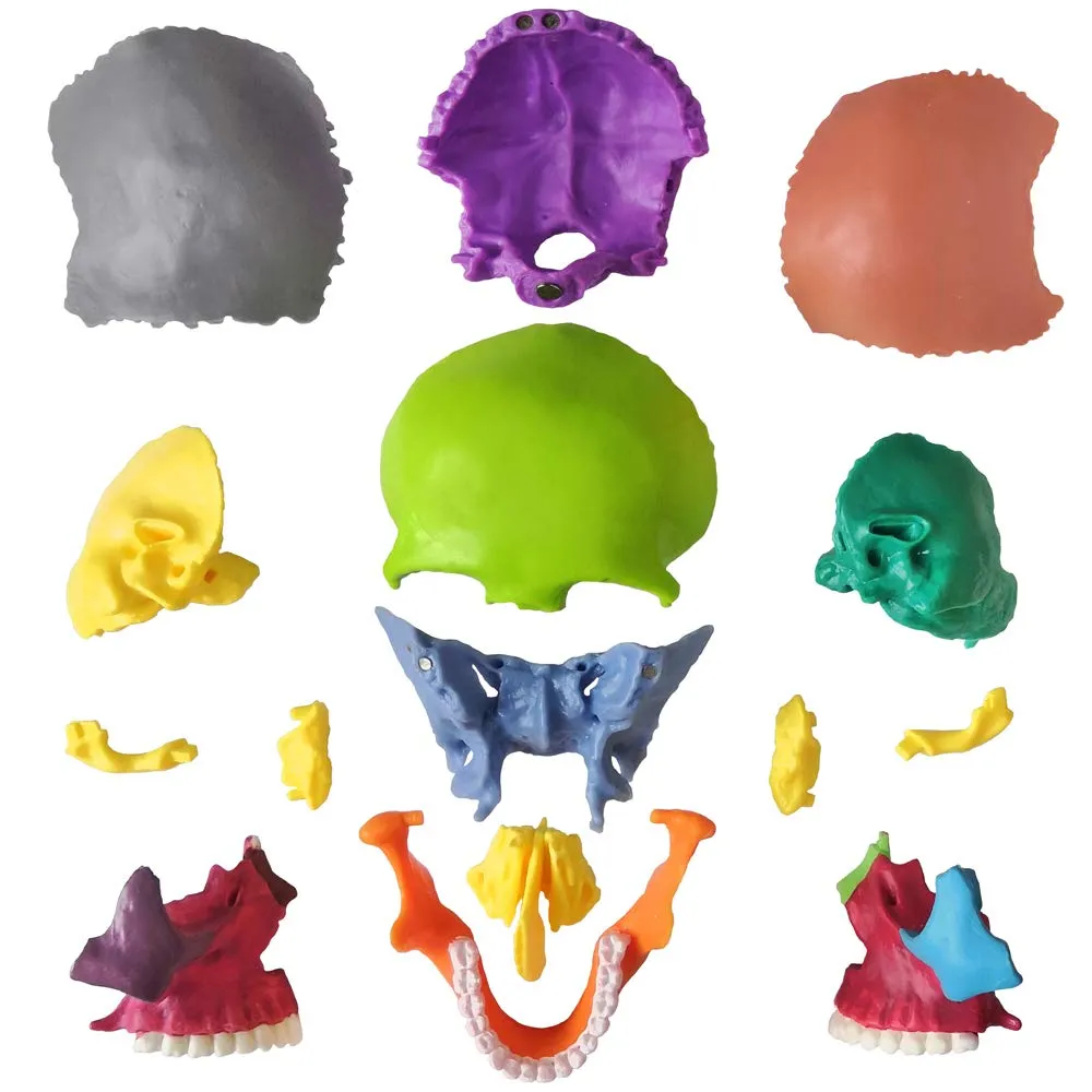 Evotech Mini Human Skull Model, Didactic 15 Parts Palm-Sized Anatomy Skull Model, Exploded Skull, Medical Anatomy and Physiology Teaching Learning, Kids Learning Education, Skull Puzzle, Colored